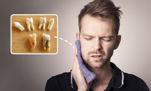 does wisdom teeth removal recovery hurt