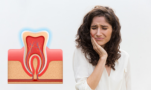 Signs You Need a Root Canal